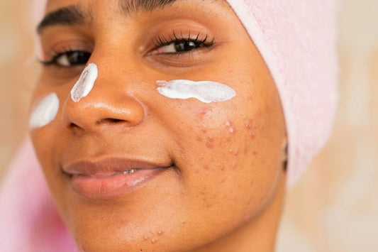 natural face moisturizer