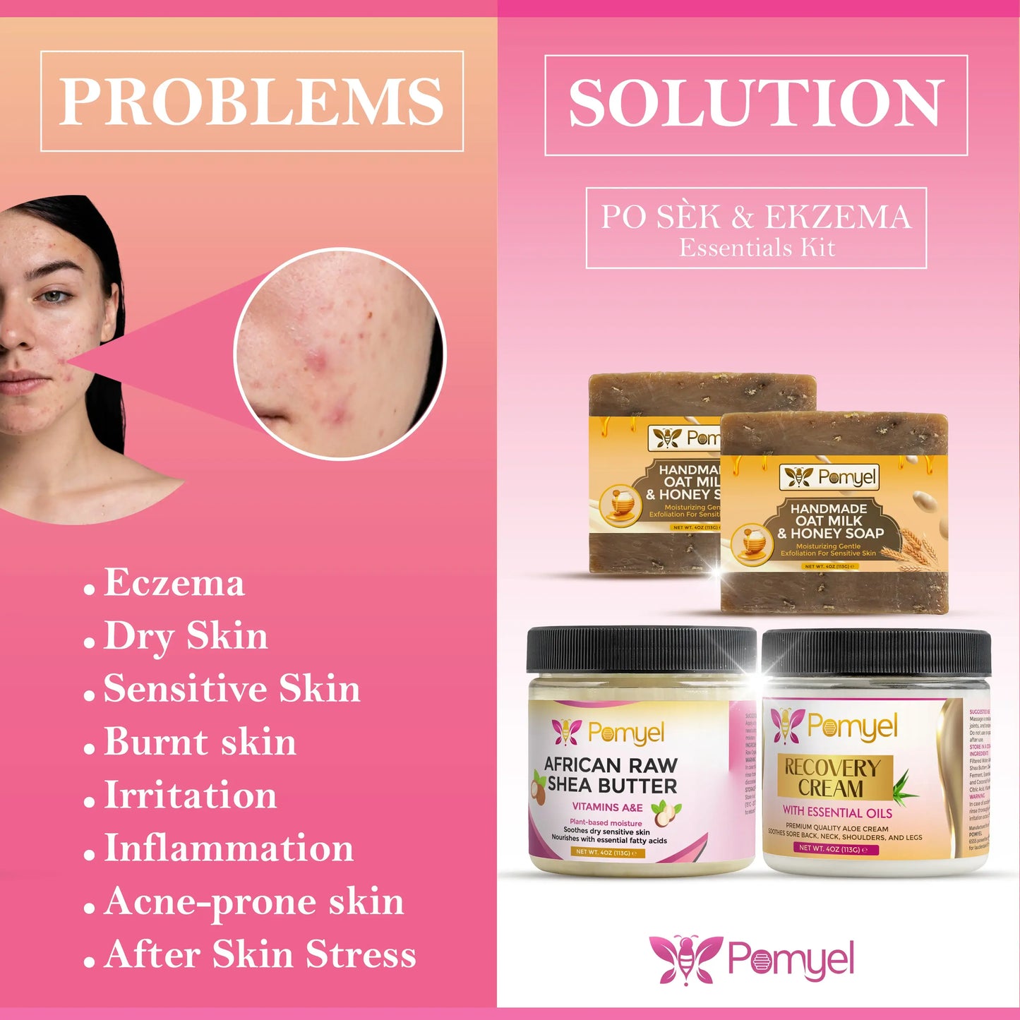 Ekzema & Po Sèk Essentials Kit
